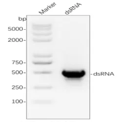 Agarose gel electrophoresis